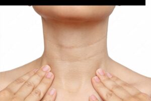 How To Get Rid Of Lines In The Neck